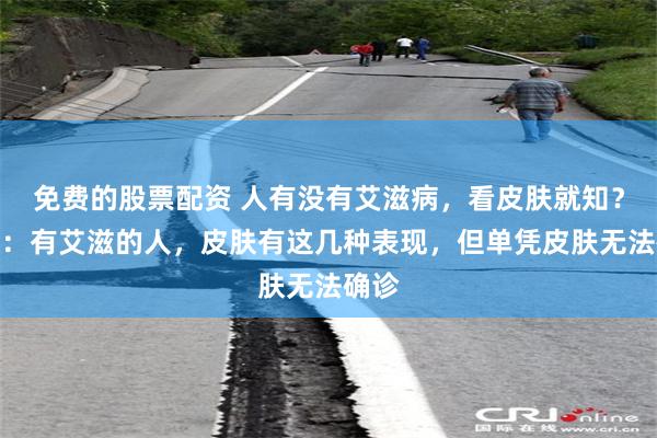 免费的股票配资 人有没有艾滋病，看皮肤就知？提醒：有艾滋的人，皮肤有这几种表现，但单凭皮肤无法确诊
